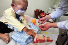 “白血病”兒童增加，甲醛危害值得關(guān)注